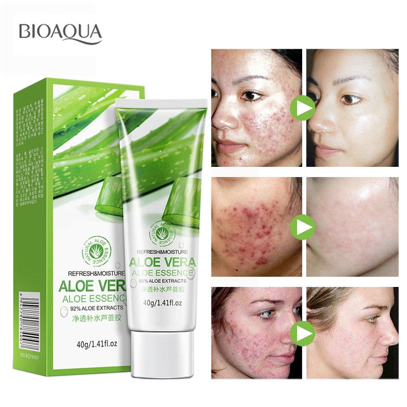 Gel Hidratante de Aloe Vera Bioaqua – Nutrición y Cuidado Integral de la Piel